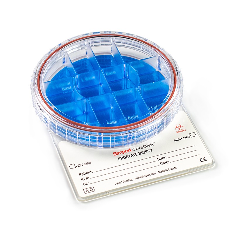 Simport M971-D12P Core Dish Prostate Biopsy Container / Qty 10
